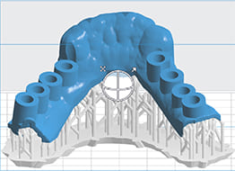 Изготовление хирургических протезов на 3D-принтере