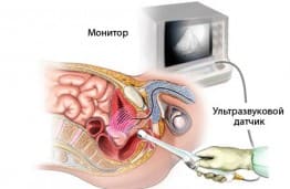 УЗИ органов малого таза. Допплерография в акушерстве.